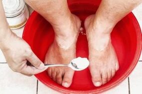 Un baño con refrixerante e xabón de alcatrán eliminará o fungo nas pernas